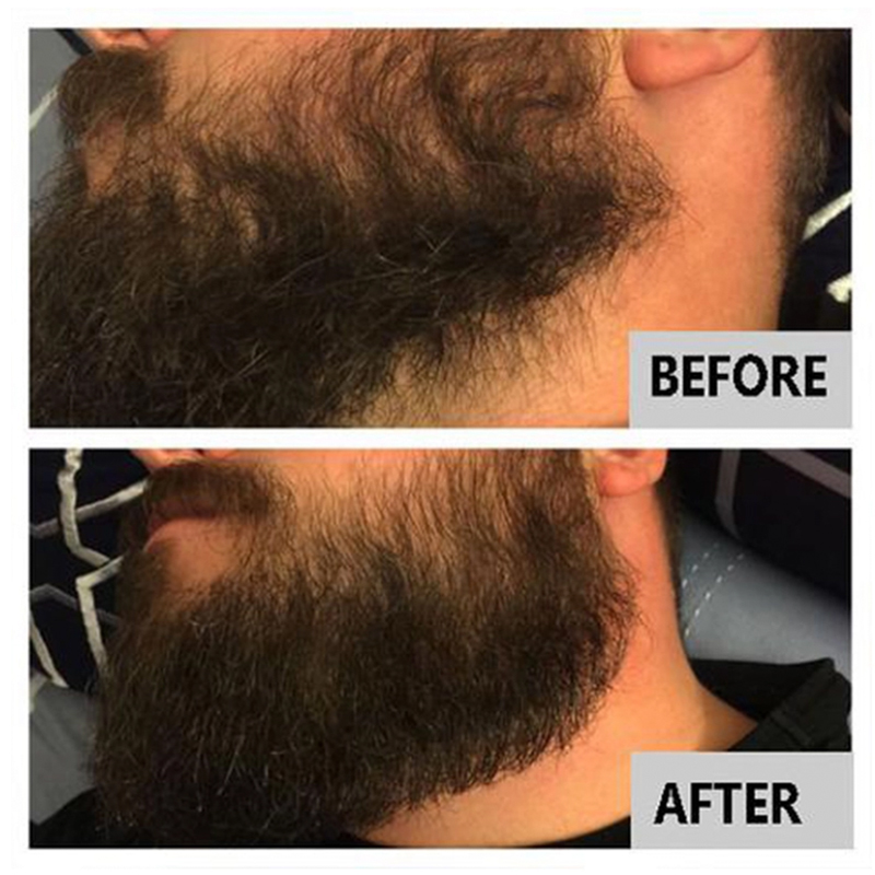 Beard Care Oil