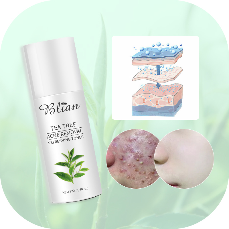 Tea Tree Acne Facial Toner