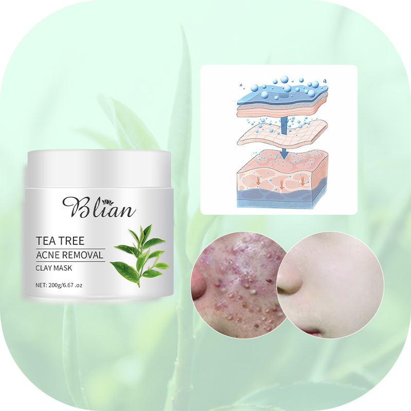 Tea Tree Acne Mud Mask