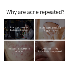 Anti-Blemish Facial Serum