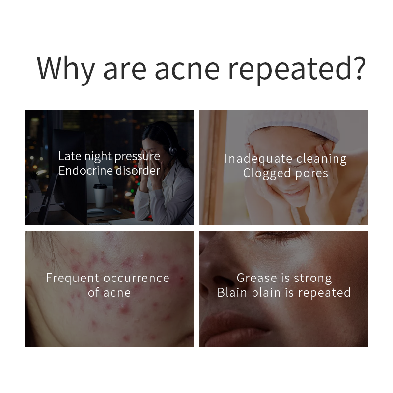 Anti-Blemish Facial Serum