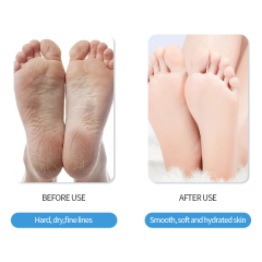 Moisturizing and Hydrating Foot Mask