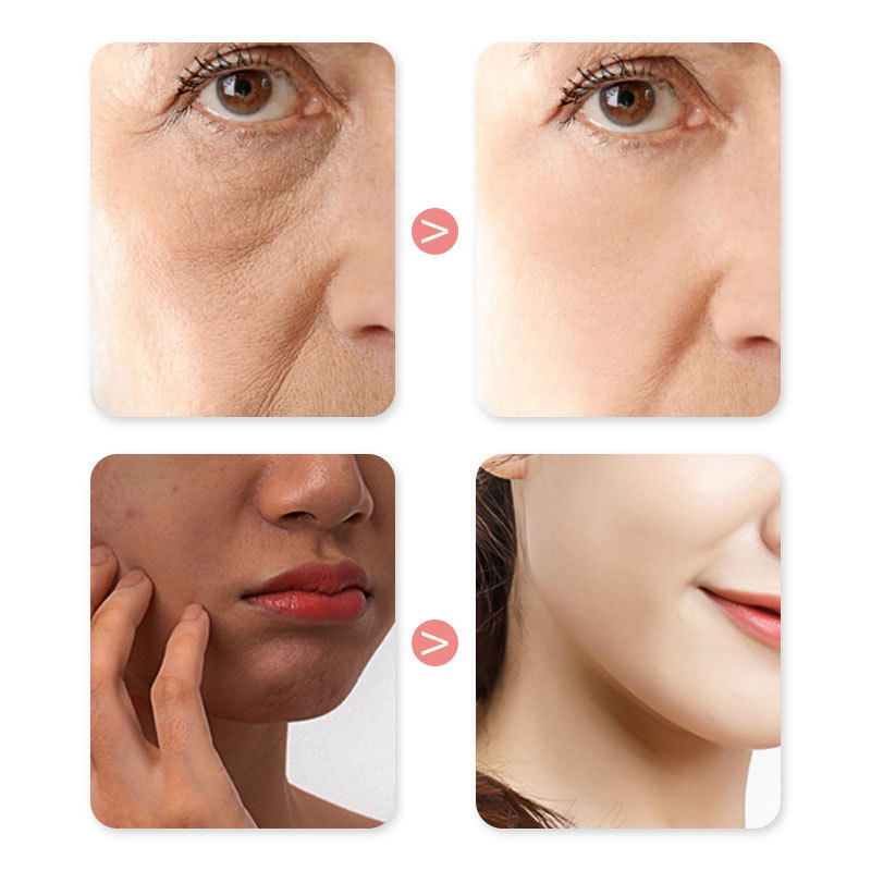 Face Moisturizing Essence