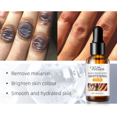 Finger Joint Whitening Serum