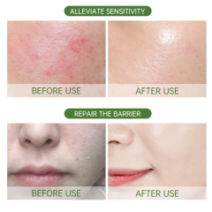 Face Care Fruit Serum Set