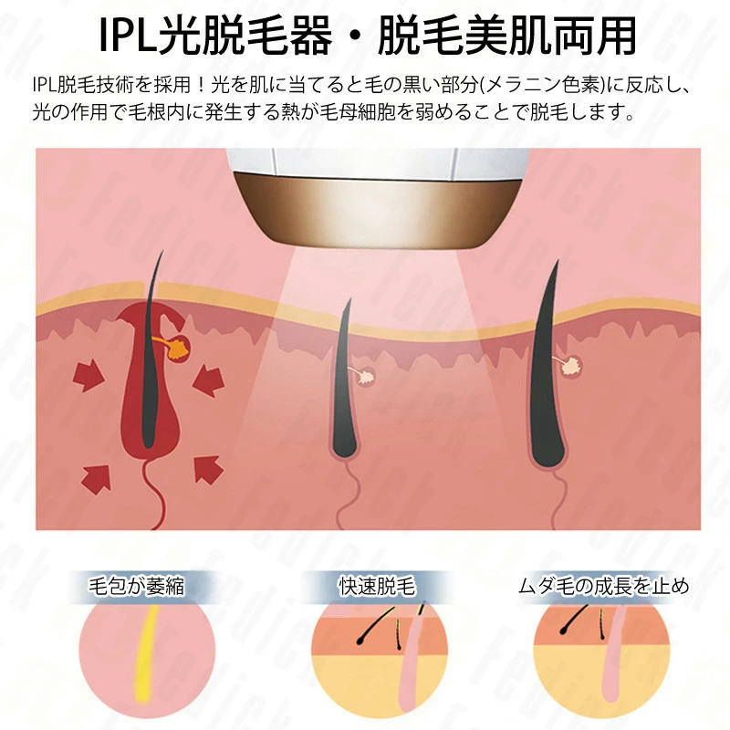 IPL光脱毛器 光脱毛器日本語取扱説明書付き 脱毛 美肌 家庭用脱毛器 冷感脱毛 永久脱毛 60万発照射 全身用 5段階レベル LCD液晶スクリーン