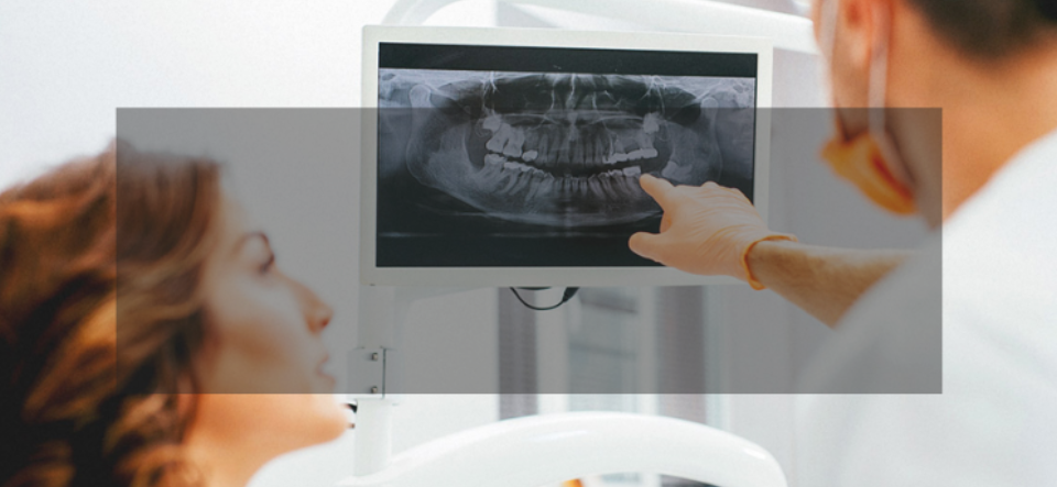 Root Canal Series