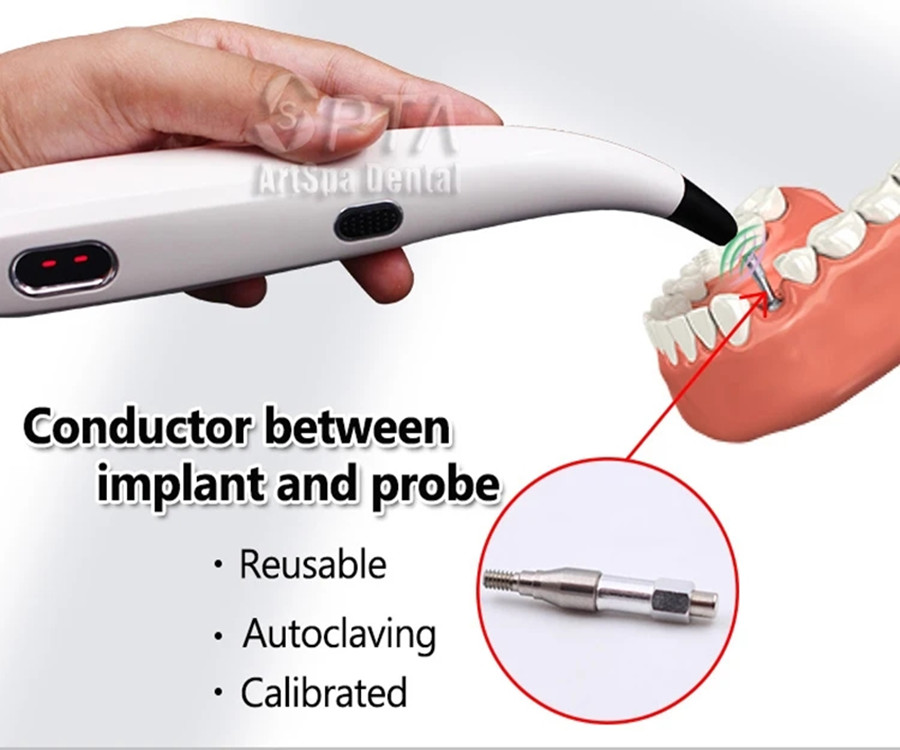 How to Properly Monitor Osseointegration After Dental Implant Surgery