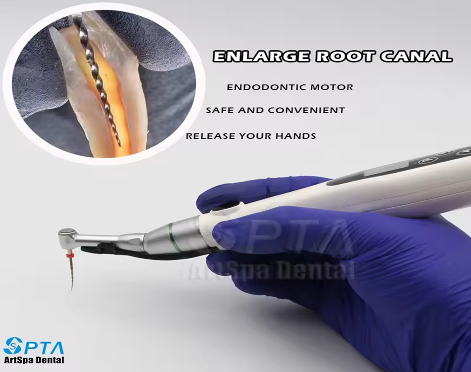 How Does Endo Motor Revolutionize Root Canal Treatment?