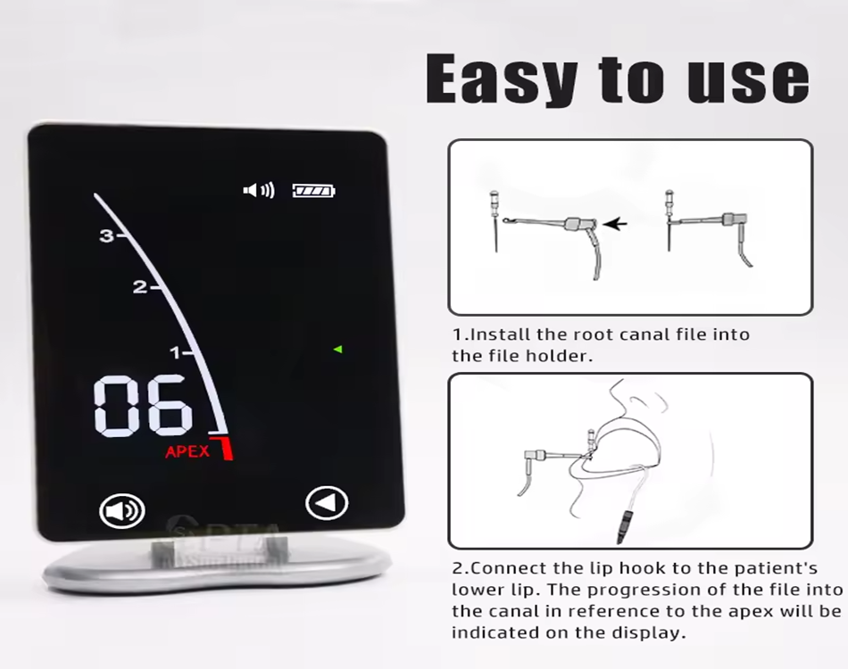 How Can Apex Locators Help You Avoid Common Root Canal Mistakes?