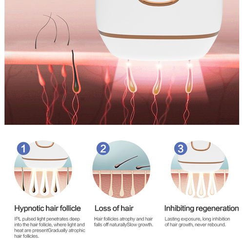 T5 IPL hair removal