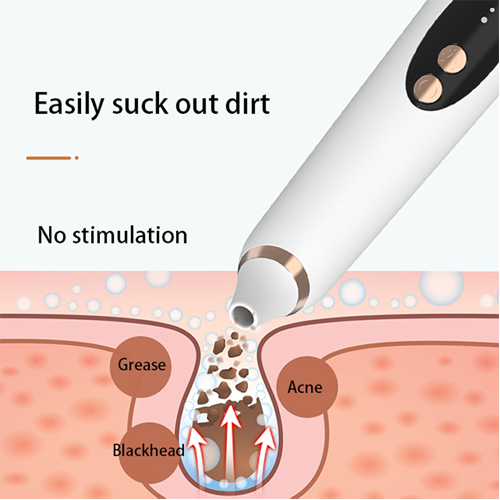 X14S blackhead removal
