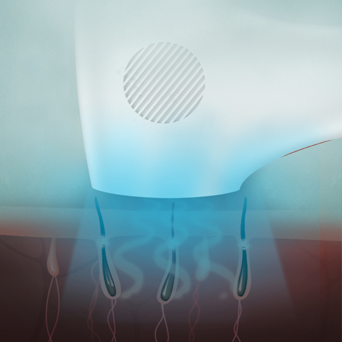 TS2 IPL hair removal