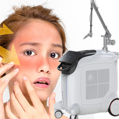 Q switched nd yag laser machine