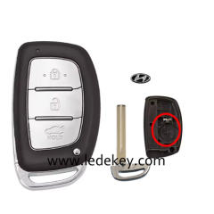 For Hyundai 3 button remote key shell with battery clamp