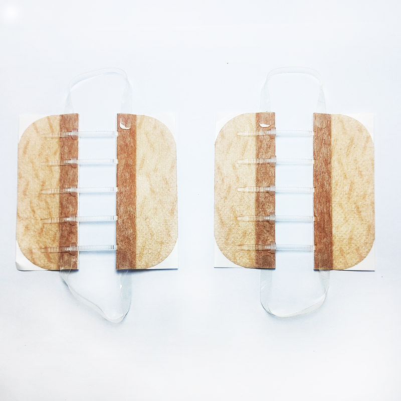 wound closure zipper and zip stitch for Medical adjustable skin