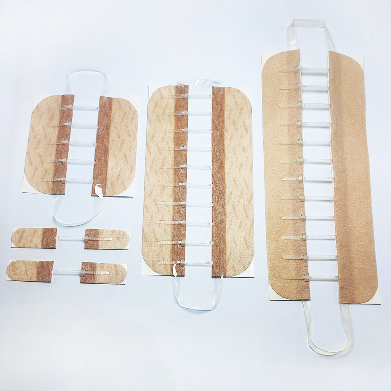 wound closure zipper and zip stitch for Medical adjustable skin,