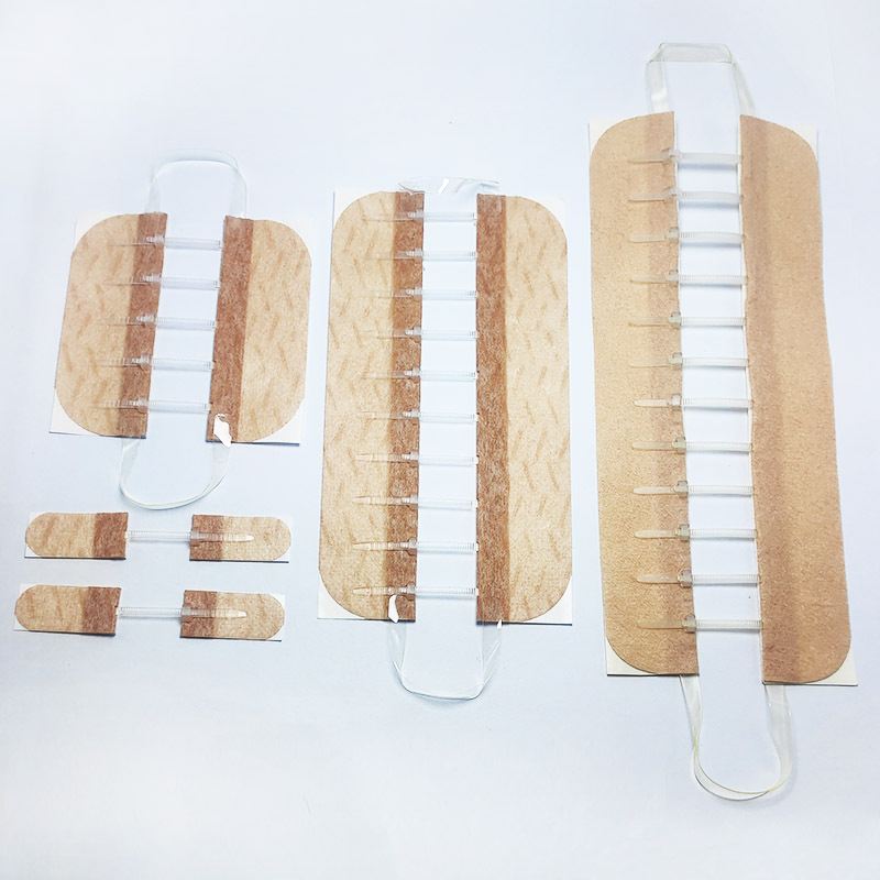 wound closure zipper and zip stitch for Medical adjustable skin