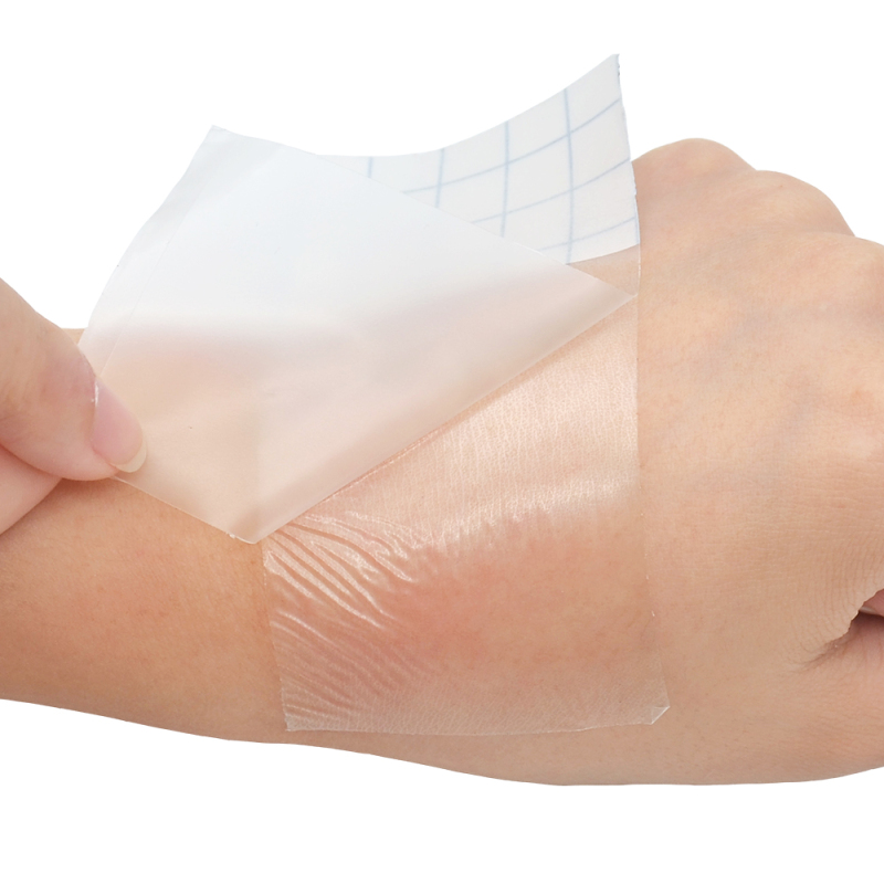 Wound dressing