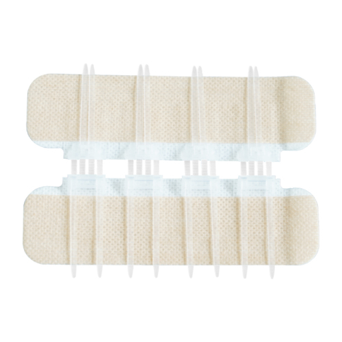 medical wound closure device surgical stitch zip stitch medic
