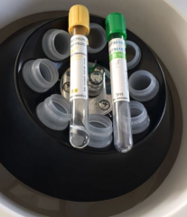 blood centrifuge platelet rich plasma for prp, centrifuge machine prp