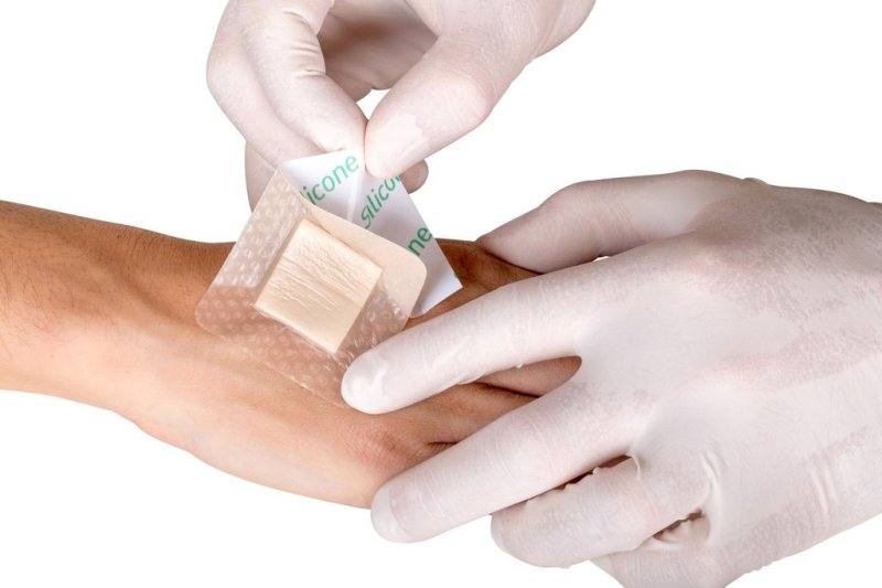 Professional cheap skinfriendly silicone foam wound dressing for deep wounds