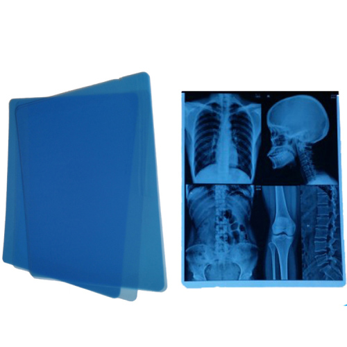 Inch Medical Dry X-Ray Film For Inkjet Printers