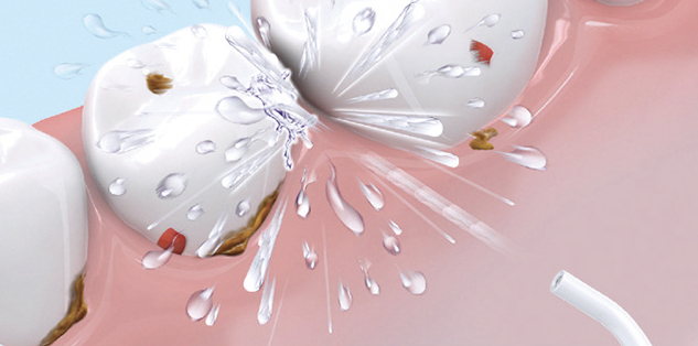 Portable oral irrigator - FC5120