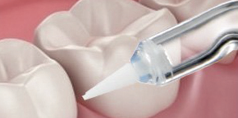 Portable oral irrigator - FC256