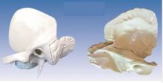 Bone enlargement model