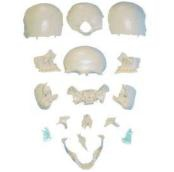 Separated skull scattered bone model