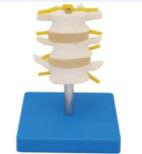 Normal lumbar spine combination (three sections)