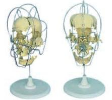 A model of skeletal separation of adult skull