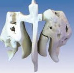 Enlarged model of ethmoid bone