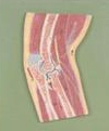 Elbow joint profile model