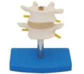 Normal lumbar spine combination (two sections)