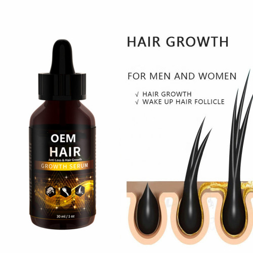 wholesale hair loss products for African 100% natural organic private label hair care products 30ml hair growth serum oil