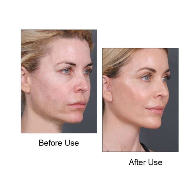 Wholesale Pink V Lifting Mask Face Lifting Bandage