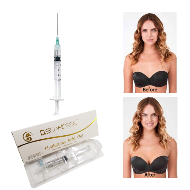 Crosslinked HA Subskin 10ml for Breast Buttock Penis Enlargement