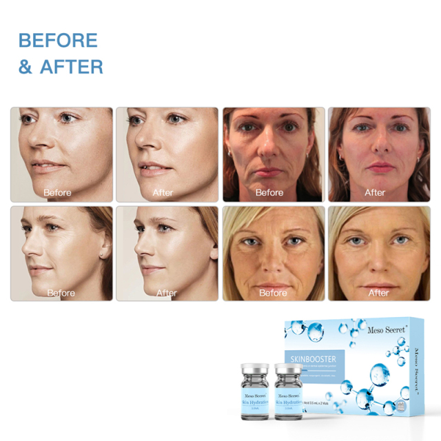 Meso Secret SkinBooster