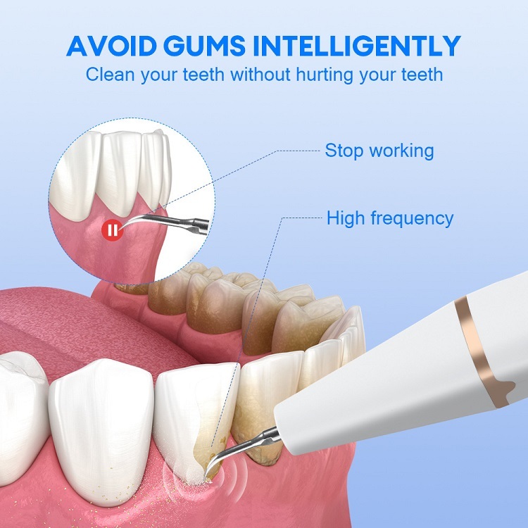 Ultrasonic Dental Cleaning Device
