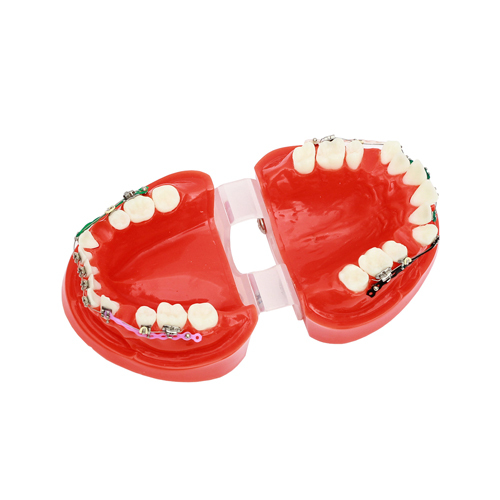 Dental Ortho Teeth Study Model With Bracket Elastolink Chain Teeth Model