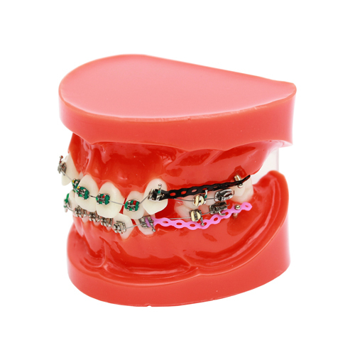 Dental Ortho Teeth Study Model With Bracket Elastolink Chain Teeth Model