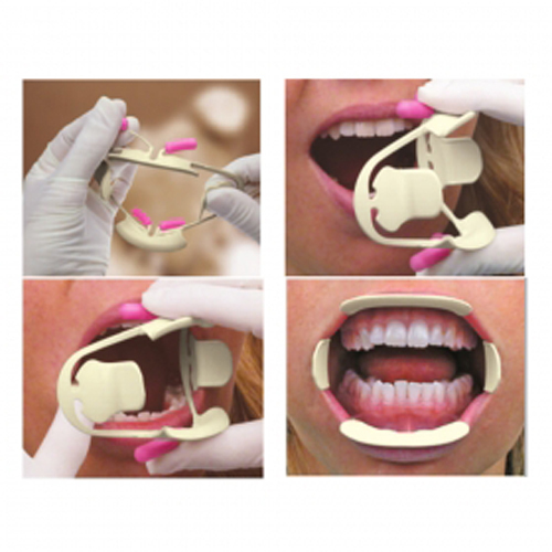 3D Oral Dental Orthodontic Mouth Opener Intraoral Cheek Lip Retractor Prop S/L