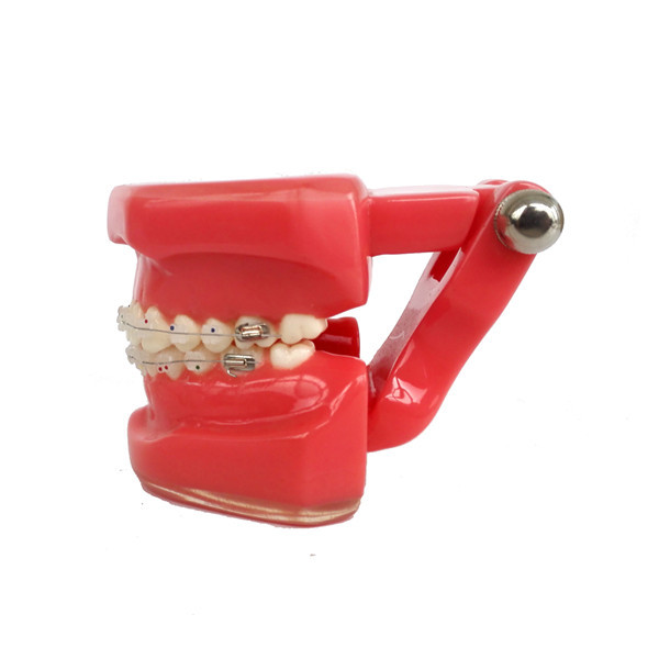 Dental Orthodontic Study Teeth Model With Ceramic &amp; Metal Brackets