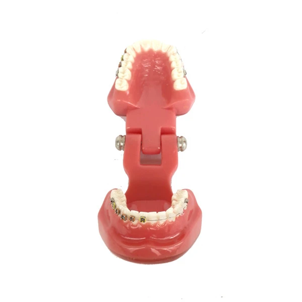 Dental Orthodontic Study Teeth Model With Ceramic &amp; Metal Brackets