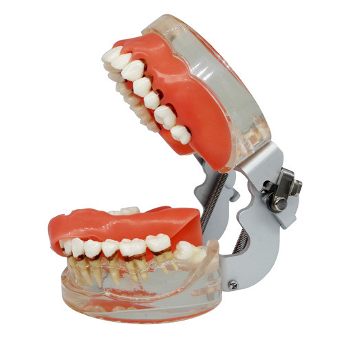 Dental Teeth Model Study Teach Standard Model Gums Removable Teeth