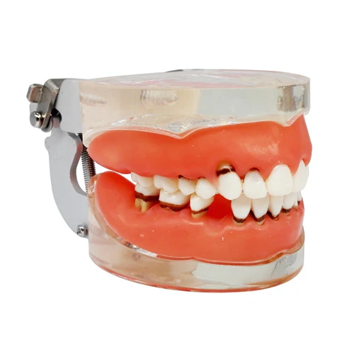 Dental Teeth Model Study Teach Standard Model Gums Removable Teeth