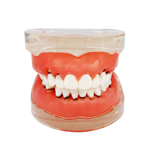 Dental Teeth Model Study Teach Standard Model Gums Removable Teeth