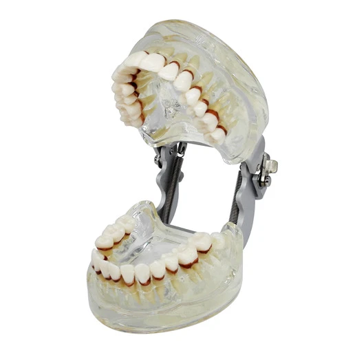 Dental Teeth Model Study Teach Standard Model Gums Removable Teeth